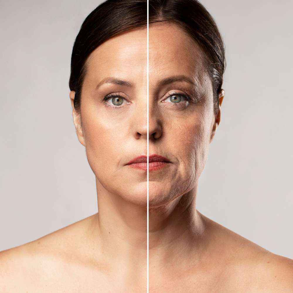 Tensado facial: SKIN TIGHTENING en Málaga