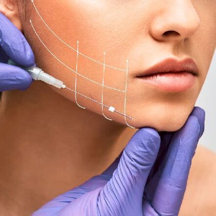 tensado facial