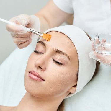 Peeling facial en Málaga