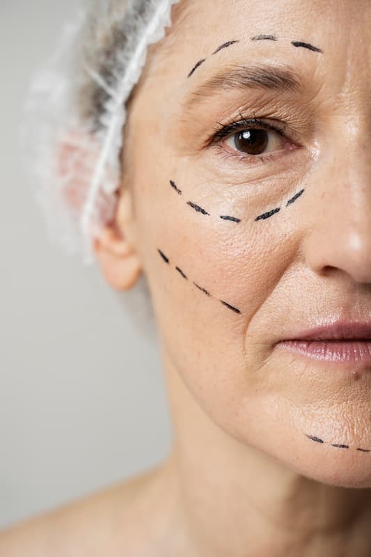 Qué es el skinbooster