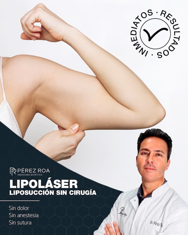 Brazos lilosucción laser