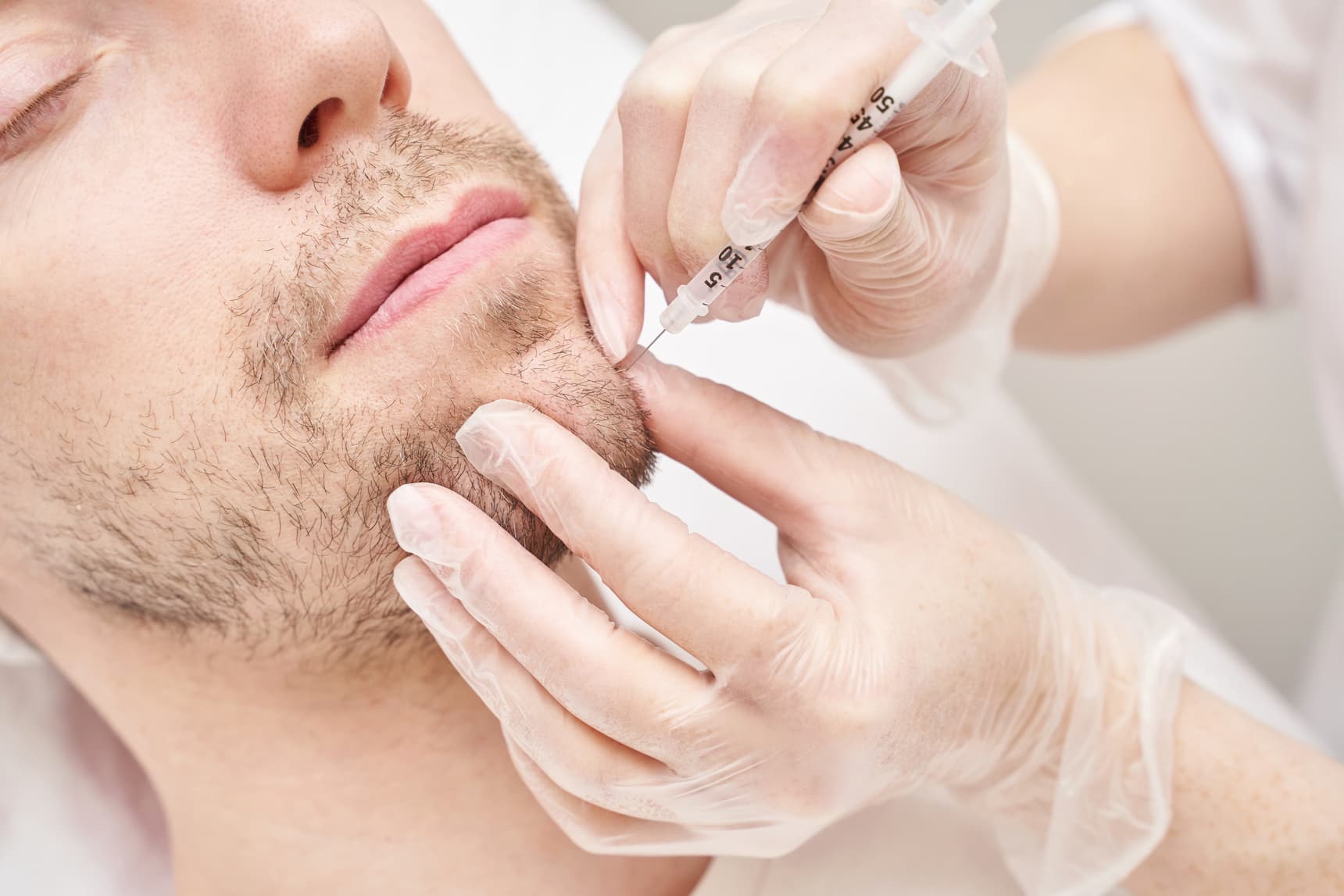 Tratamientos faciales para hombres