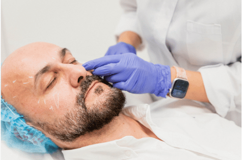 Masculinización facial
