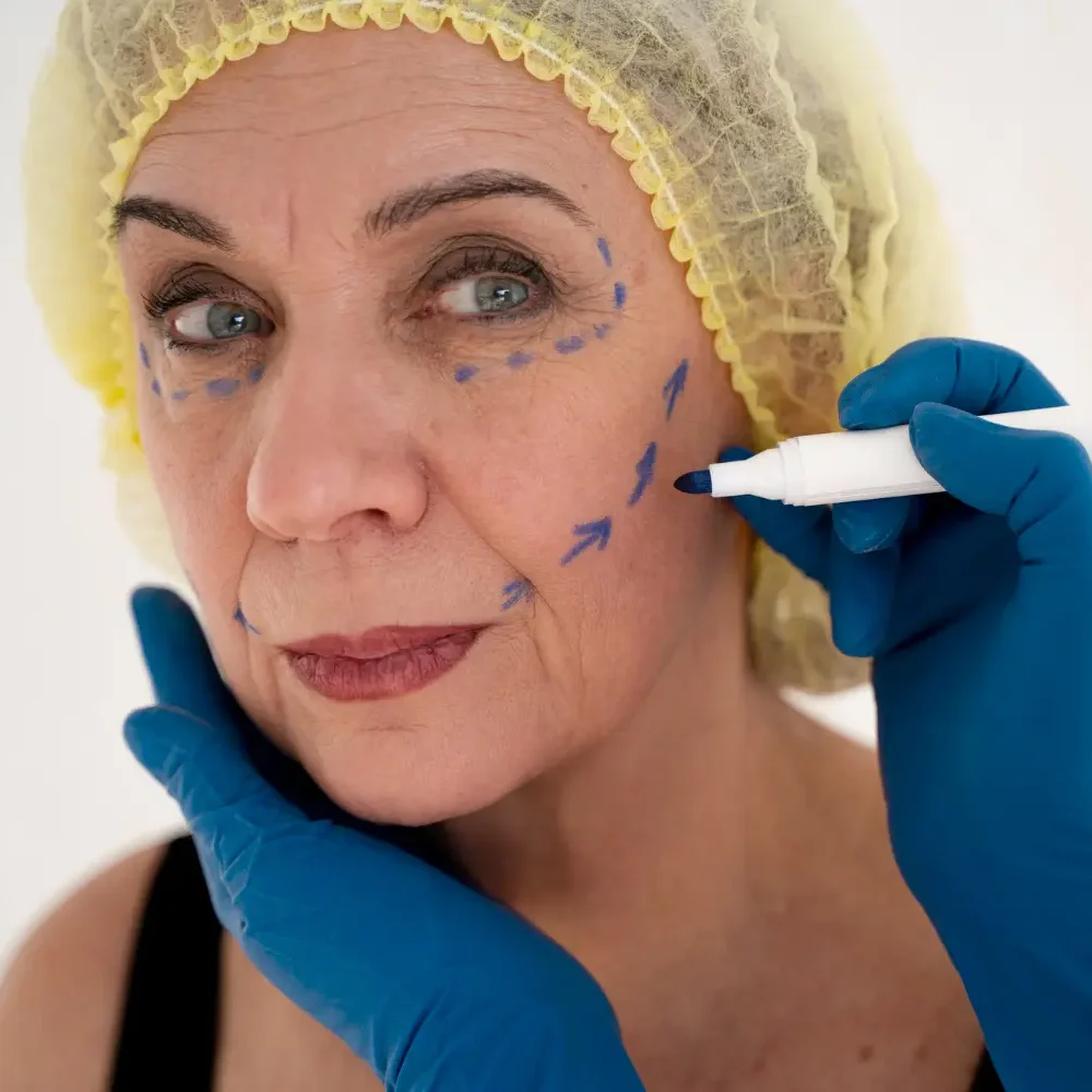Endolifting Facial en Málaga