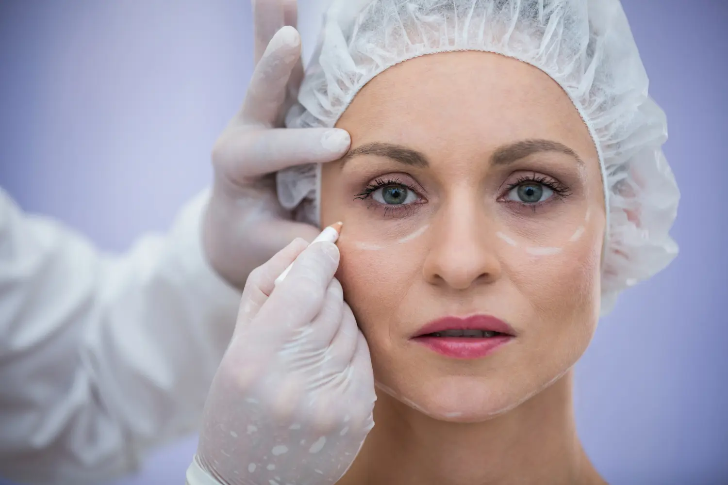 endolifting facial