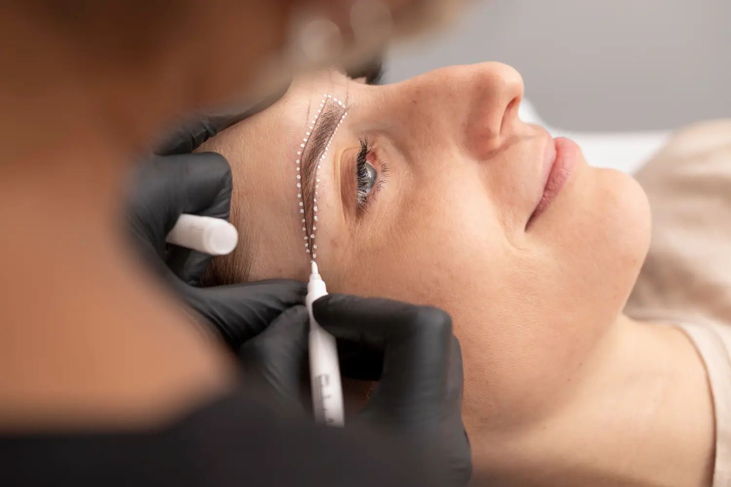 Lifting de cejas en Málaga